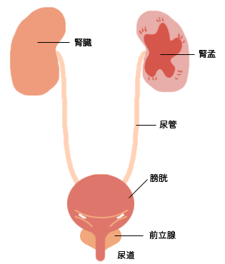 血尿 スケール