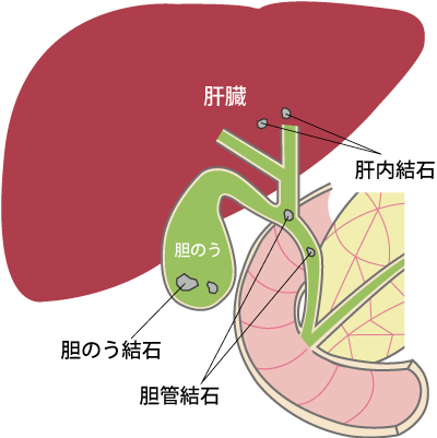 役割 胆嚢 1分で分かる肝臓・胆のう・すい臓のしくみ [肝臓・すい臓・胆のうの病気]